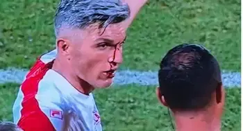 Video | La furia de Daniel Torres por la agresión en la que hinchas del DIM le rompieron la cara